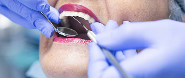Best Emergency Dentist for Knocked-Out Tooth in Prosper, TX